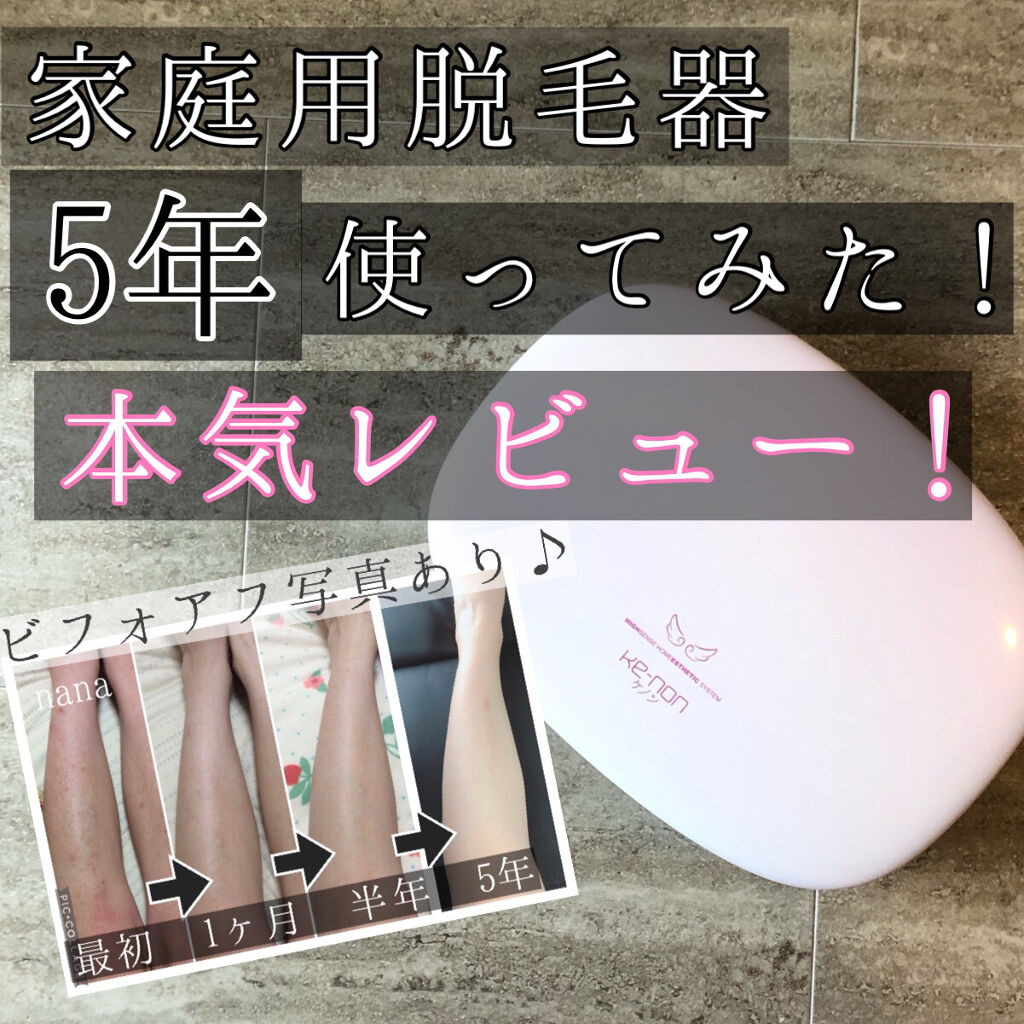 光美容器KE-NON（ケノン）/エムテック/家庭用脱毛器を使ったクチコミ（1枚目）