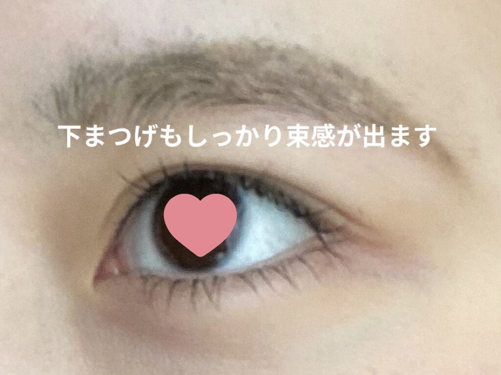 ナチュラルアイビュー/MYM/美容液を使ったクチコミ（3枚目）