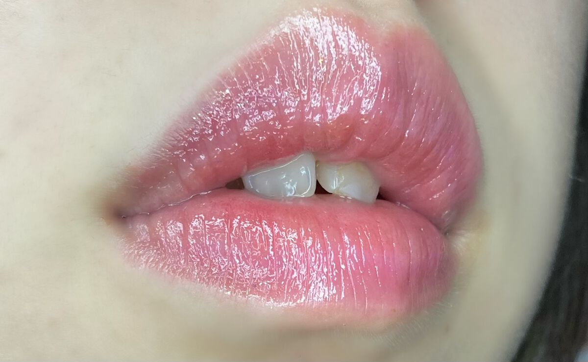 リシェ ダイヤモンド ティント セラム/Visée/リップケアを使ったクチコミ(3枚目)