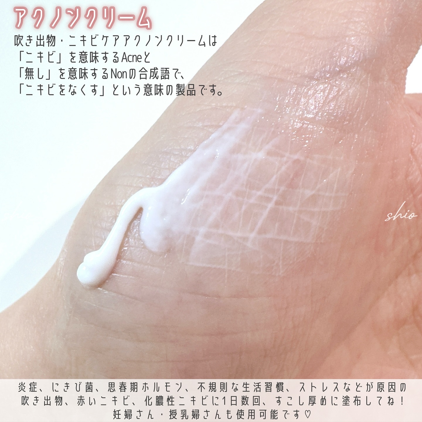 アクノンクリーム/東亜製薬/その他スキンケアを使ったクチコミ（2枚目）