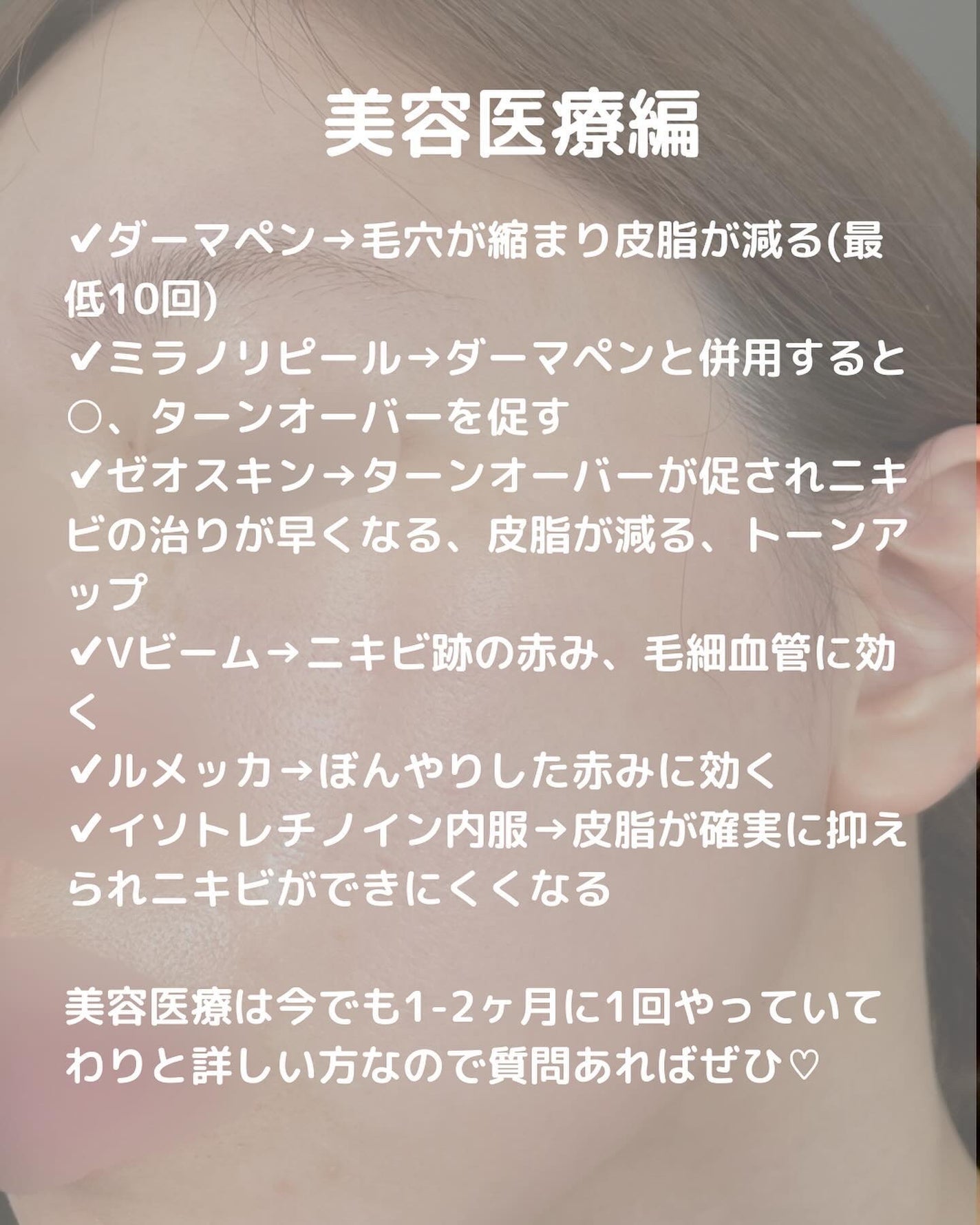 グラナティブレチノイド/LovemeTouch/美容液を使ったクチコミ(4枚目)