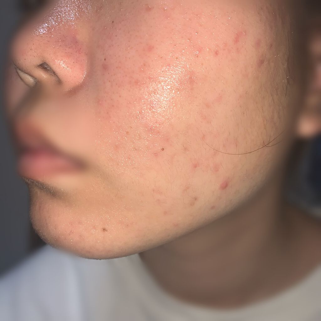 ロゼット洗顔パスタ 海泥スムース/ロゼット/洗顔フォームを使ったクチコミ（3枚目）