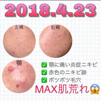 乳液・敏感肌用・高保湿タイプ/無印良品/乳液を使ったクチコミ(2枚目)