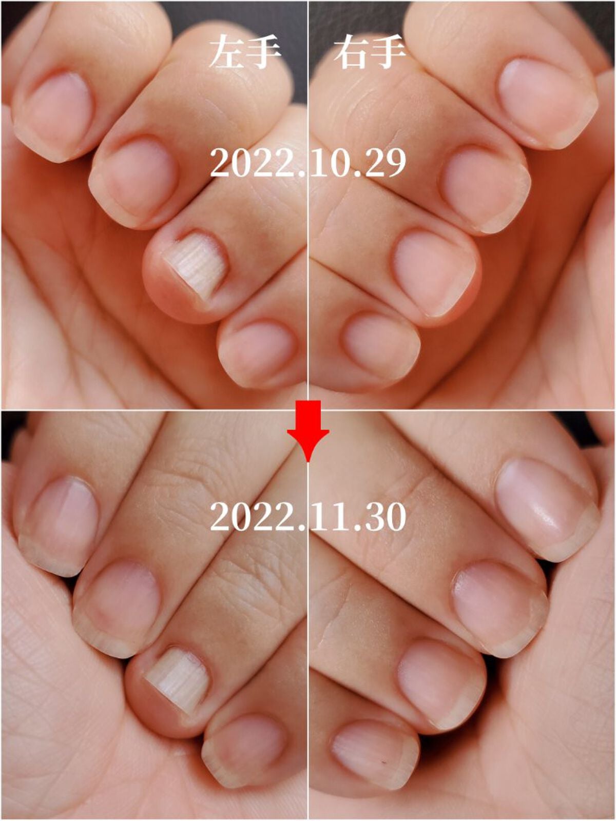 アンティセプト/LCN/ネイルオイル・トリートメントを使ったクチコミ(3枚目)