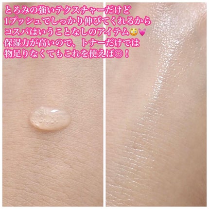 ブレミッシュケア トニックエッセンス/ISOI/化粧水を使ったクチコミ(5枚目)