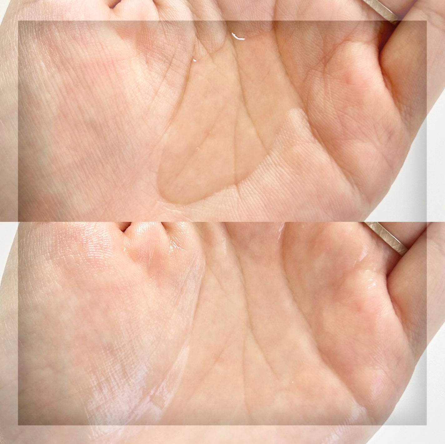 アルティメットカーミングソリューションアンプル /Pyunkang Yul/美容液を使ったクチコミ(4枚目)