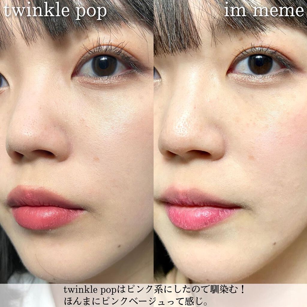 グリッターリングアイスティック/TWINKLE POP/グリッターを使ったクチコミ（3枚目）