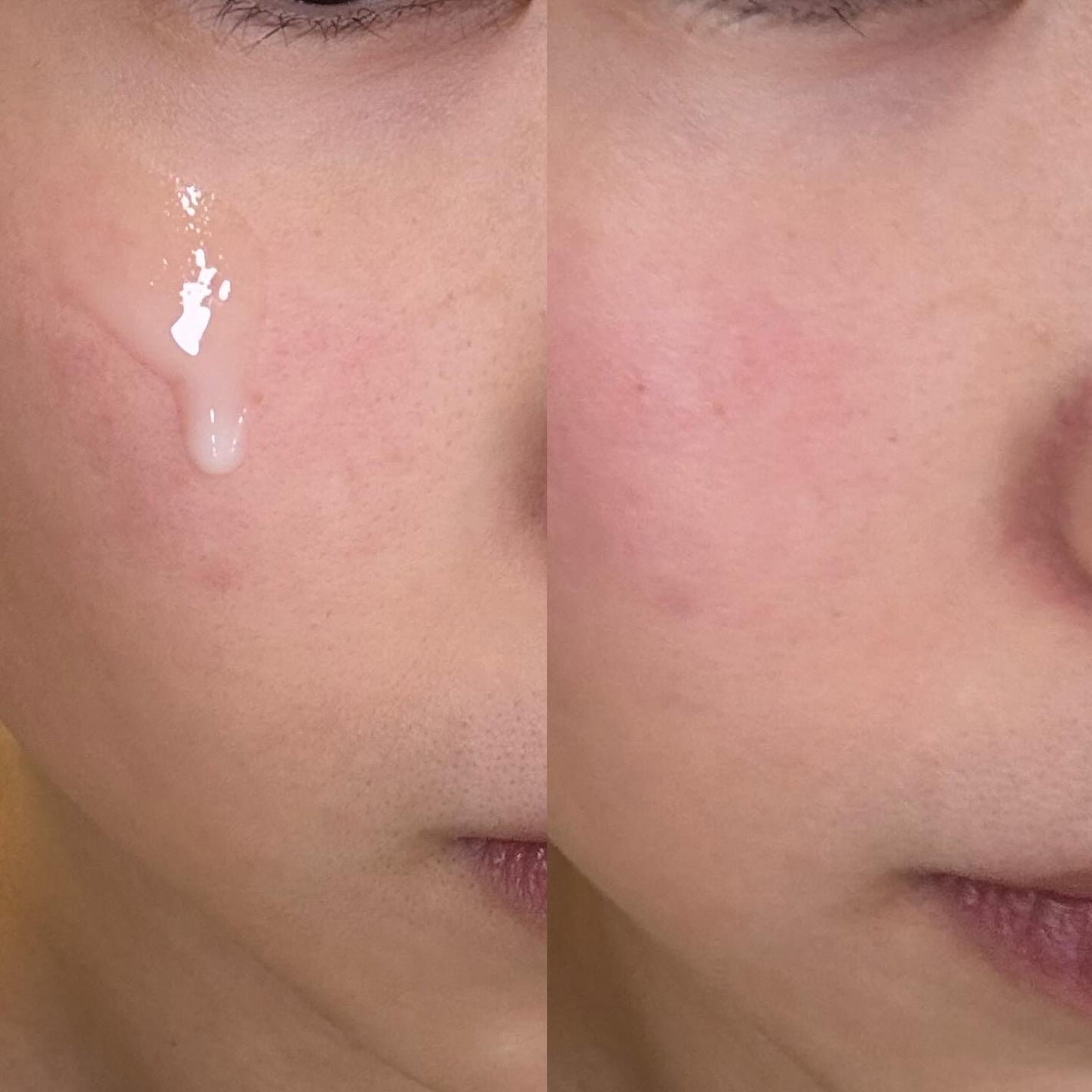 ガラクトポアセラム/SAM'U/美容液を使ったクチコミ(7枚目)