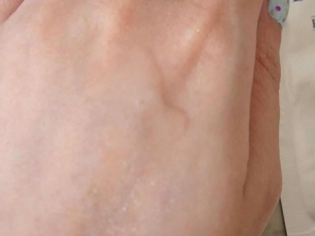 レーヌブランシュ ブライトフェイスウォーター/L'OCCITANE/化粧水を使ったクチコミ(2枚目)