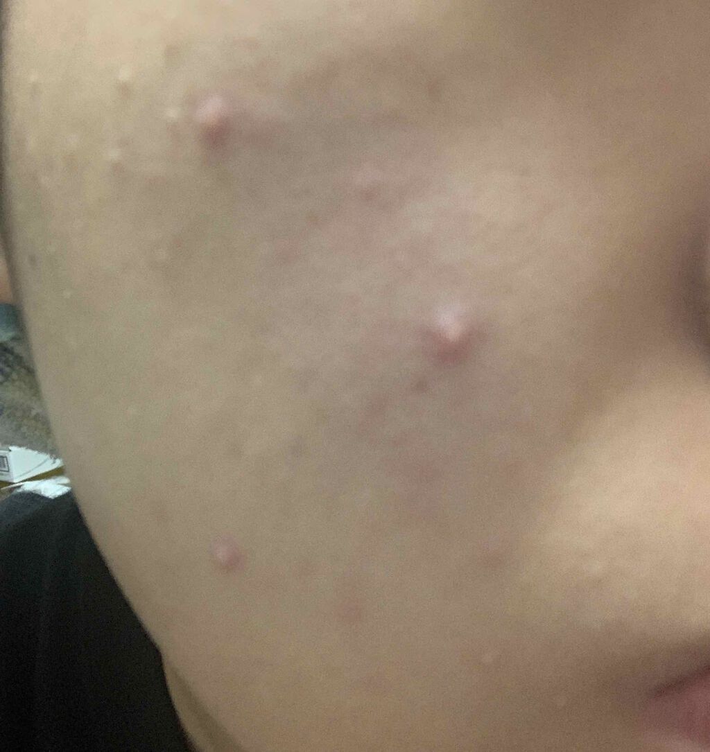 ザ・タイムR アクア/IPSA/化粧水を使ったクチコミ（1枚目）