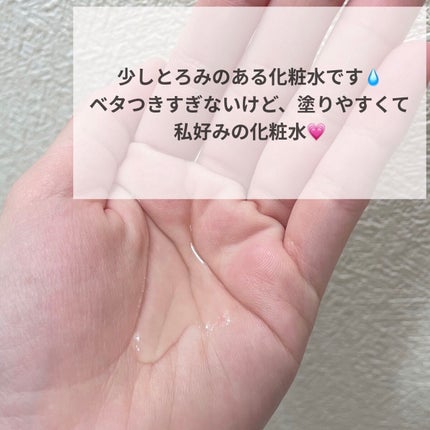 SOC 薬用ヒアルロン酸配合 スキンローション/澁谷油脂/化粧水を使ったクチコミ(3枚目)