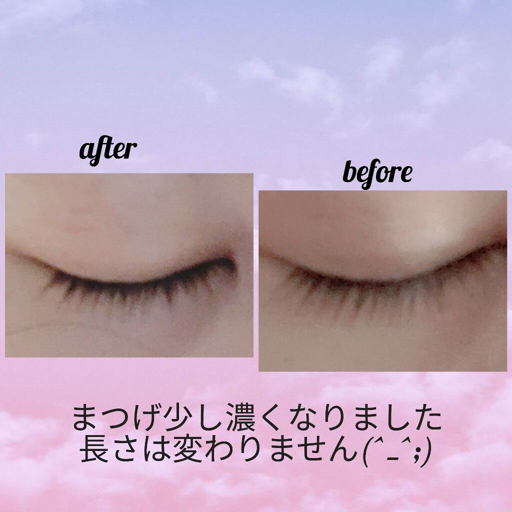 スカルプD ボーテ ピュアフリーアイラッシュセラム プレミアム/アンファー(スカルプD)/まつげ美容液を使ったクチコミ(2枚目)