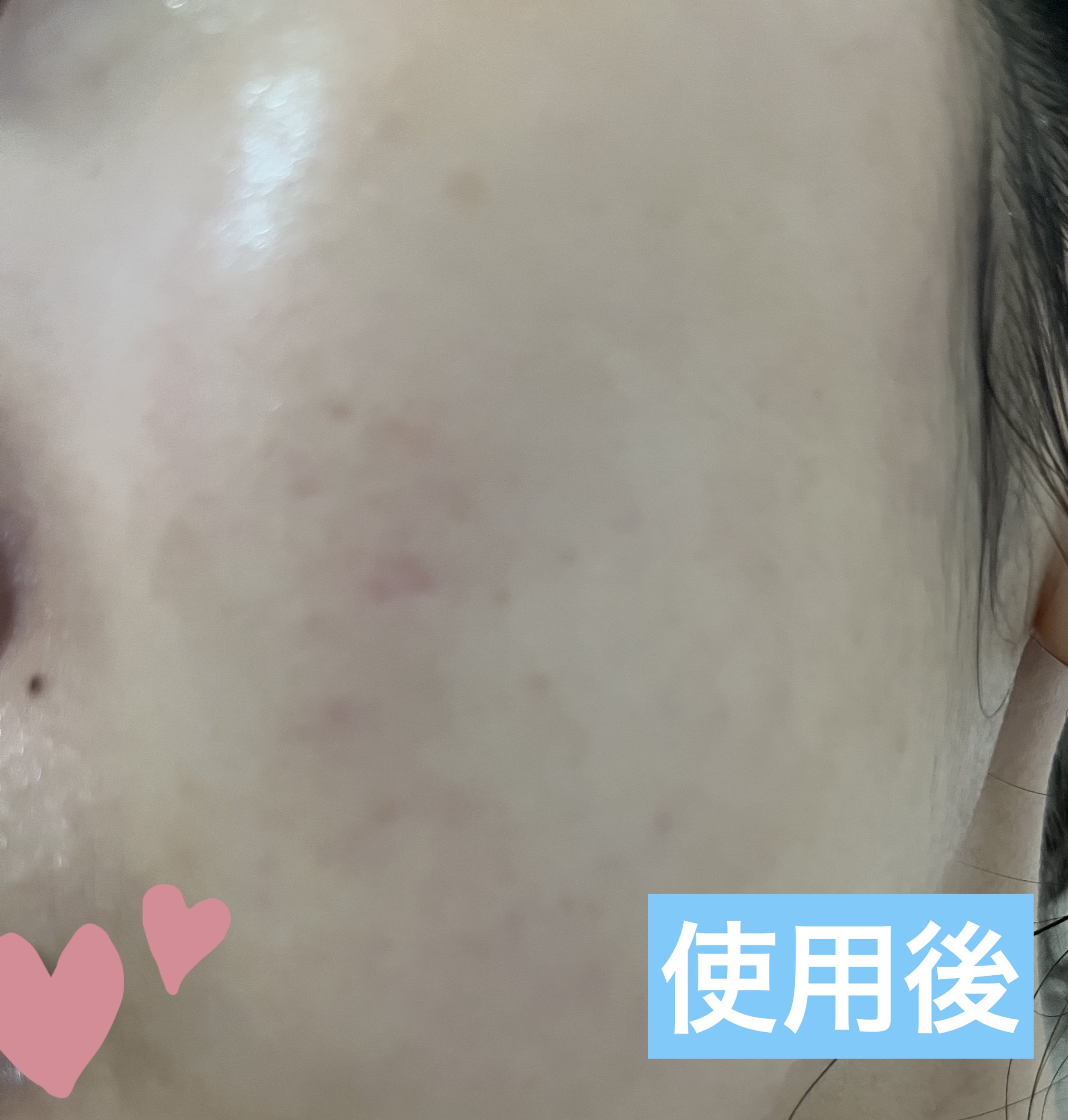 ルルルン ハイドラ EX マスク/ルルルン/シートマスク・パックを使ったクチコミ（3枚目）