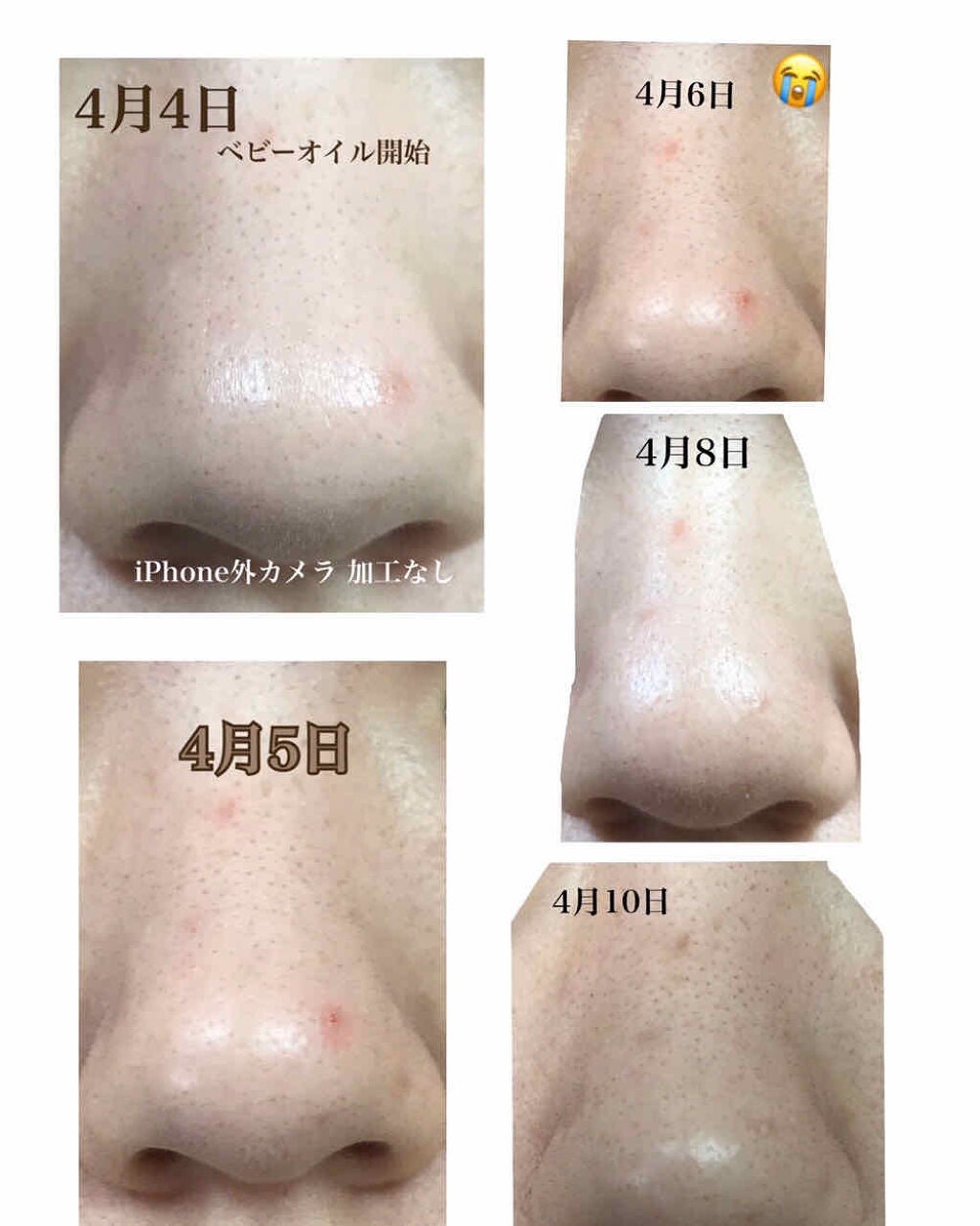 ジョンソン ベビーオイル 無香料/ジョンソンベビー/ボディオイルを使ったクチコミ(2枚目)