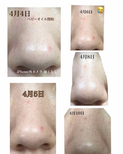 ベビーオイル 無香料/ジョンソンベビー/ボディオイルを使ったクチコミ(2枚目)