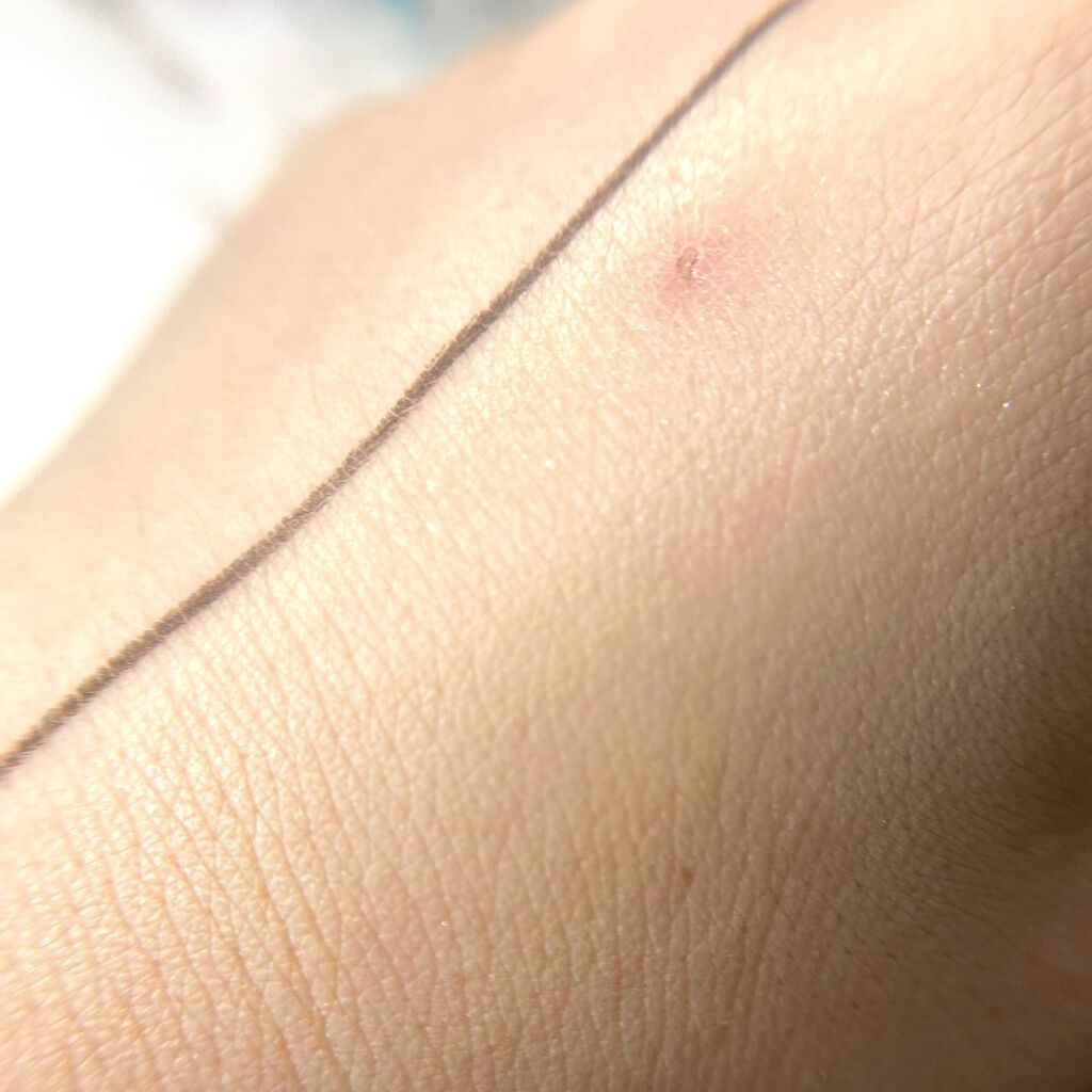 ブライトアップスキンファンデーション/UUUNI/クッションファンデーションを使ったクチコミ(6枚目)