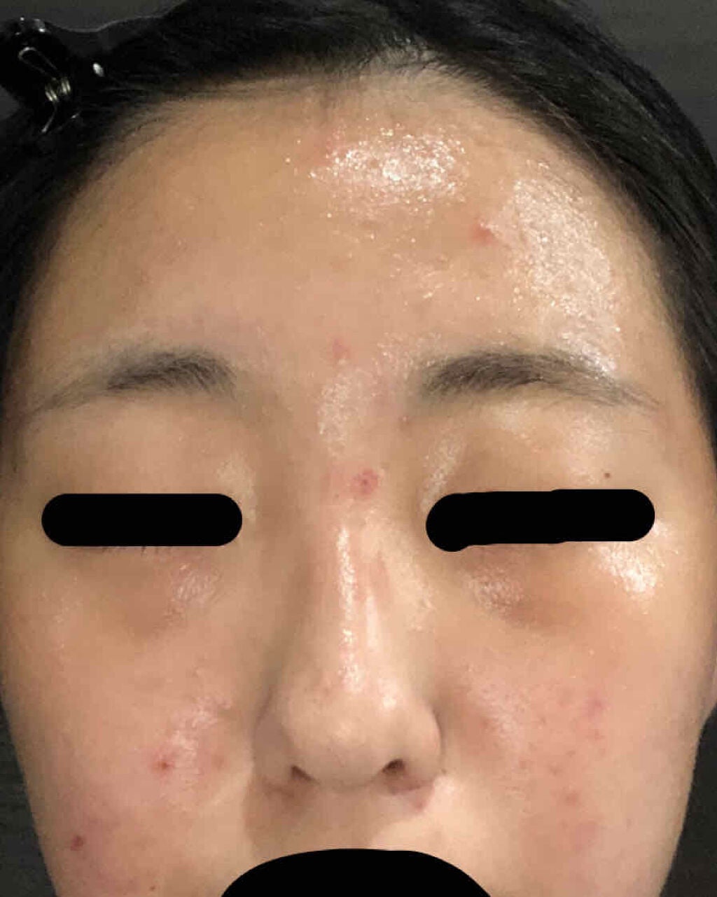 ハトムギ保湿ジェル(ナチュリエ スキンコンディショニングジェル)/ナチュリエ/美容液を使ったクチコミ(3枚目)