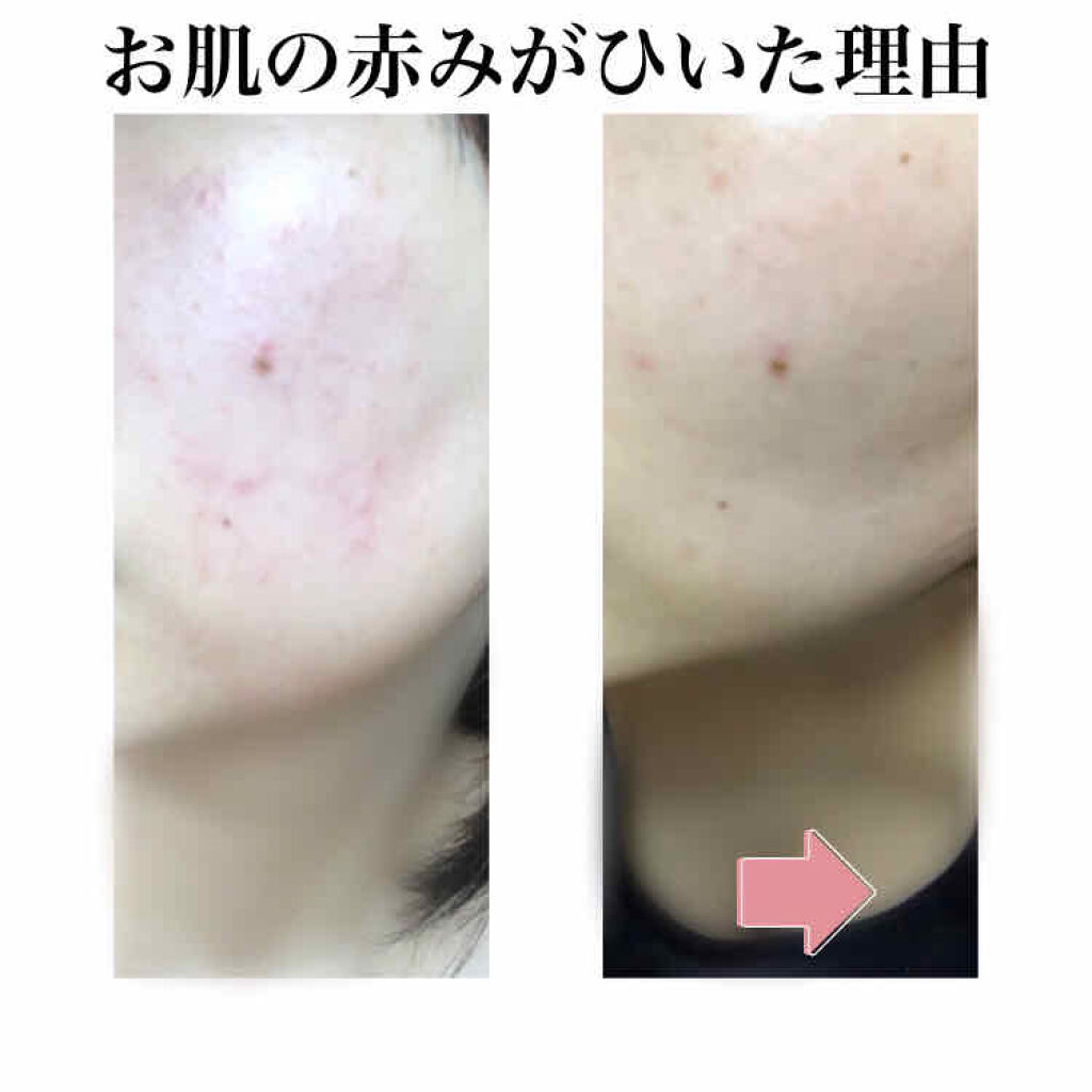 エイジングケア化粧水 高保湿タイプ 無印良品を使った口コミ 肌の赤みがひどい私の選択 それは ノンアル By きなこもち 乾燥肌 代前半 Lips