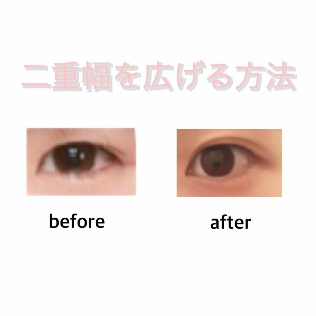 アイトーク/アイトーク/二重まぶた用アイテムを使ったクチコミ（1枚目）