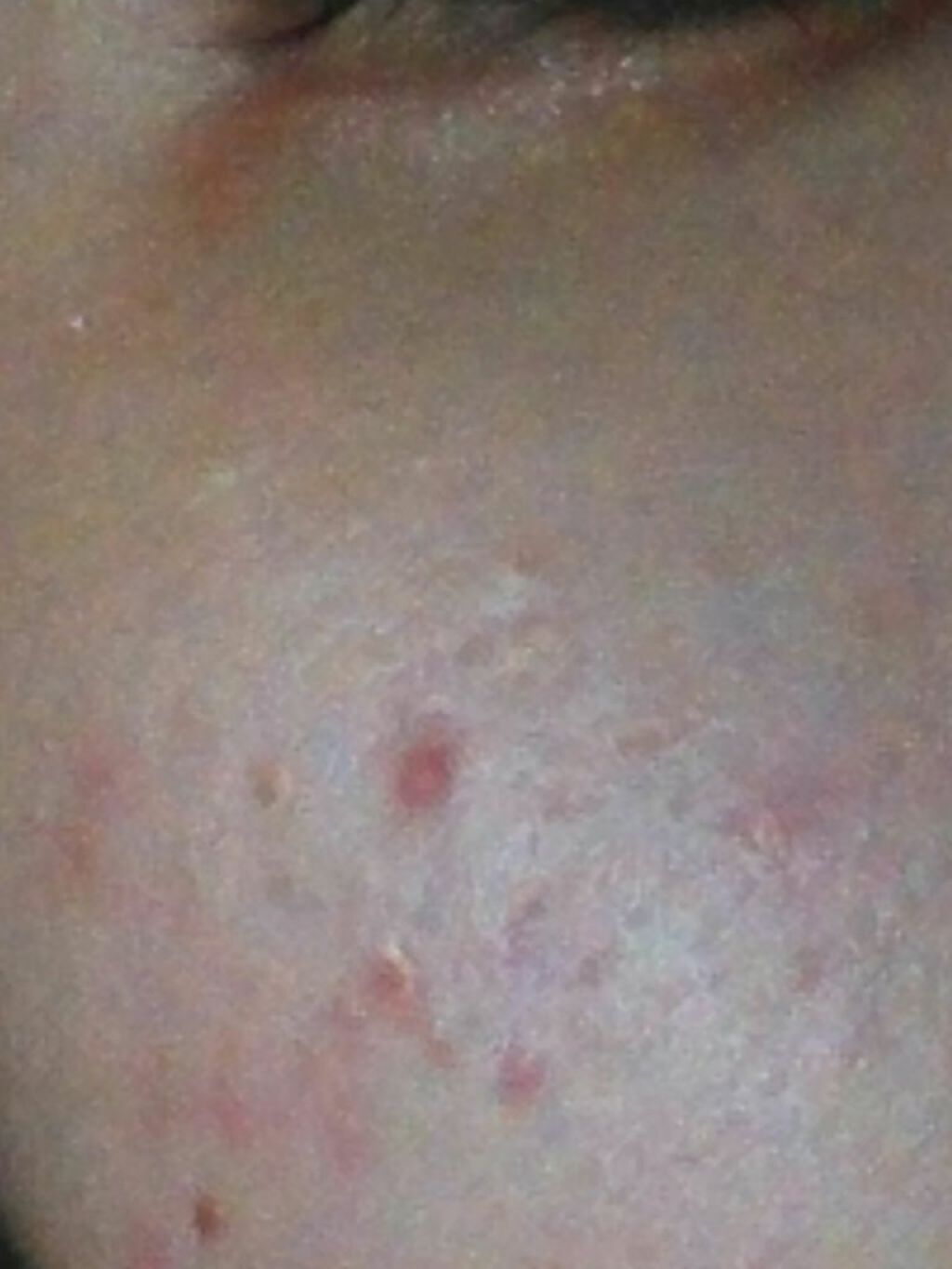 薬用スキンミルク/オードムーゲ/乳液を使ったクチコミ（2枚目）