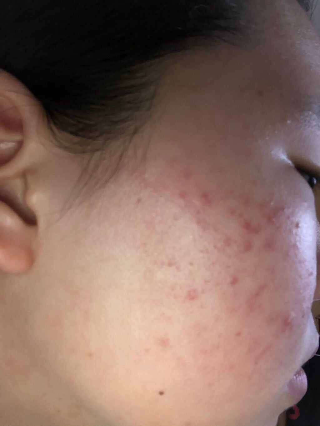 ビタミンC/Dear-Natura (ディアナチュラ)/健康サプリメントを使ったクチコミ(2枚目)