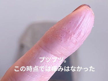 Gel Nail/セリア/マニキュアを使ったクチコミ（2枚目）