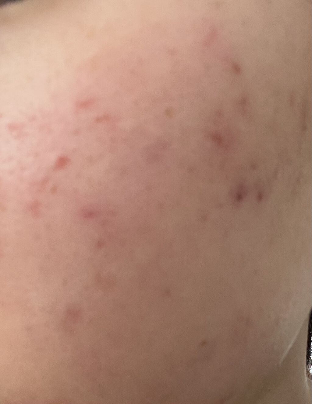 スキンケアセット D/雪肌粋/スキンケアキットを使ったクチコミ（2枚目）