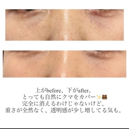 コレクチュールエクラプールレジュー/クレ・ド・ポー ボーテ/リキッドコンシーラーを使ったクチコミ(4枚目)