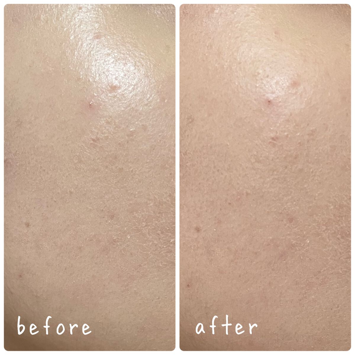 ポアセバムパウダー/One-day's you/ルースパウダーを使ったクチコミ(3枚目)