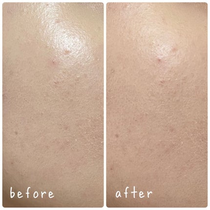 ポアセバムパウダー/One-day's you/ルースパウダーを使ったクチコミ(3枚目)