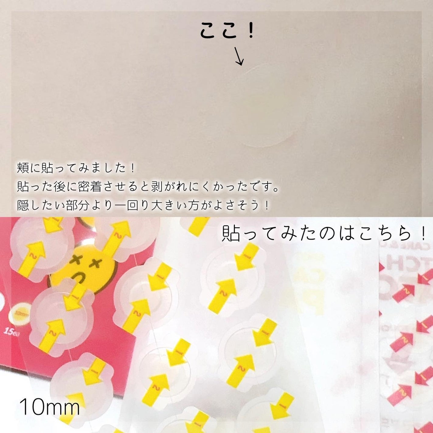 キャッチミーパッチ/CATCH ME PATCH/にきびパッチを使ったクチコミ(5枚目)