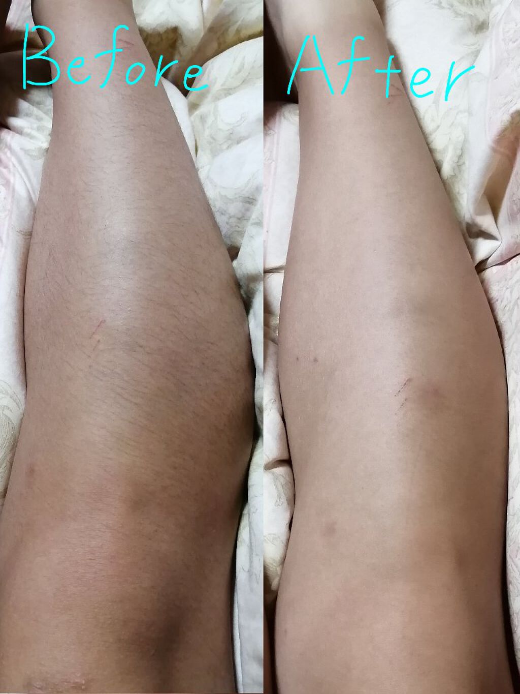 モテ肌  除毛パッド/セリア/ムダ毛ケアを使ったクチコミ（2枚目）