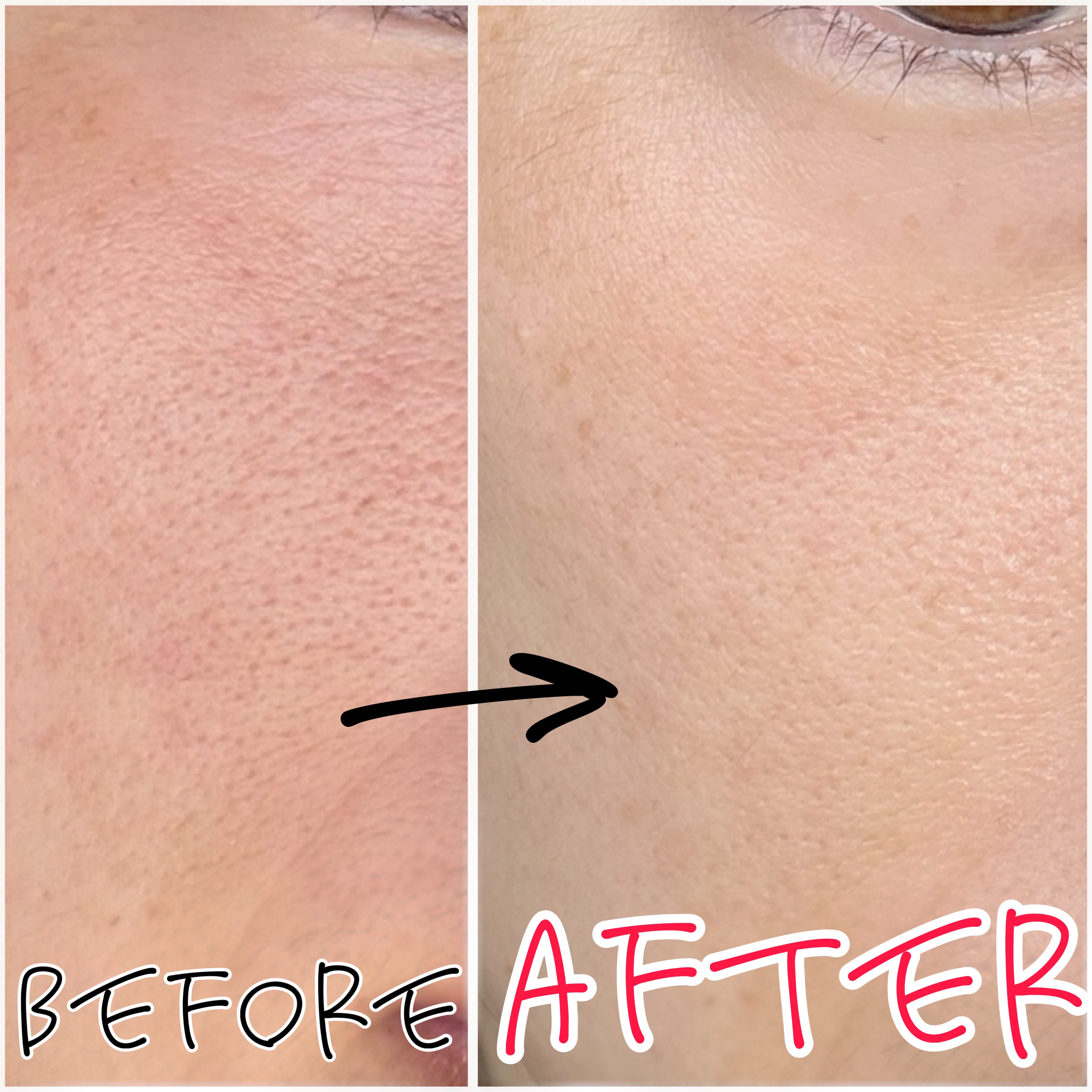 レッドブースター リードルショット100/VT/ブースター・導入液を使ったクチコミ（3枚目）