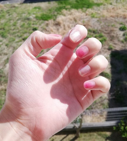 サンリオネイル/DAISO/マニキュアを使ったクチコミ(2枚目)