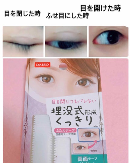 アイテープ 埋没式両面テープ/DAISO/二重まぶた用アイテムを使ったクチコミ(2枚目)