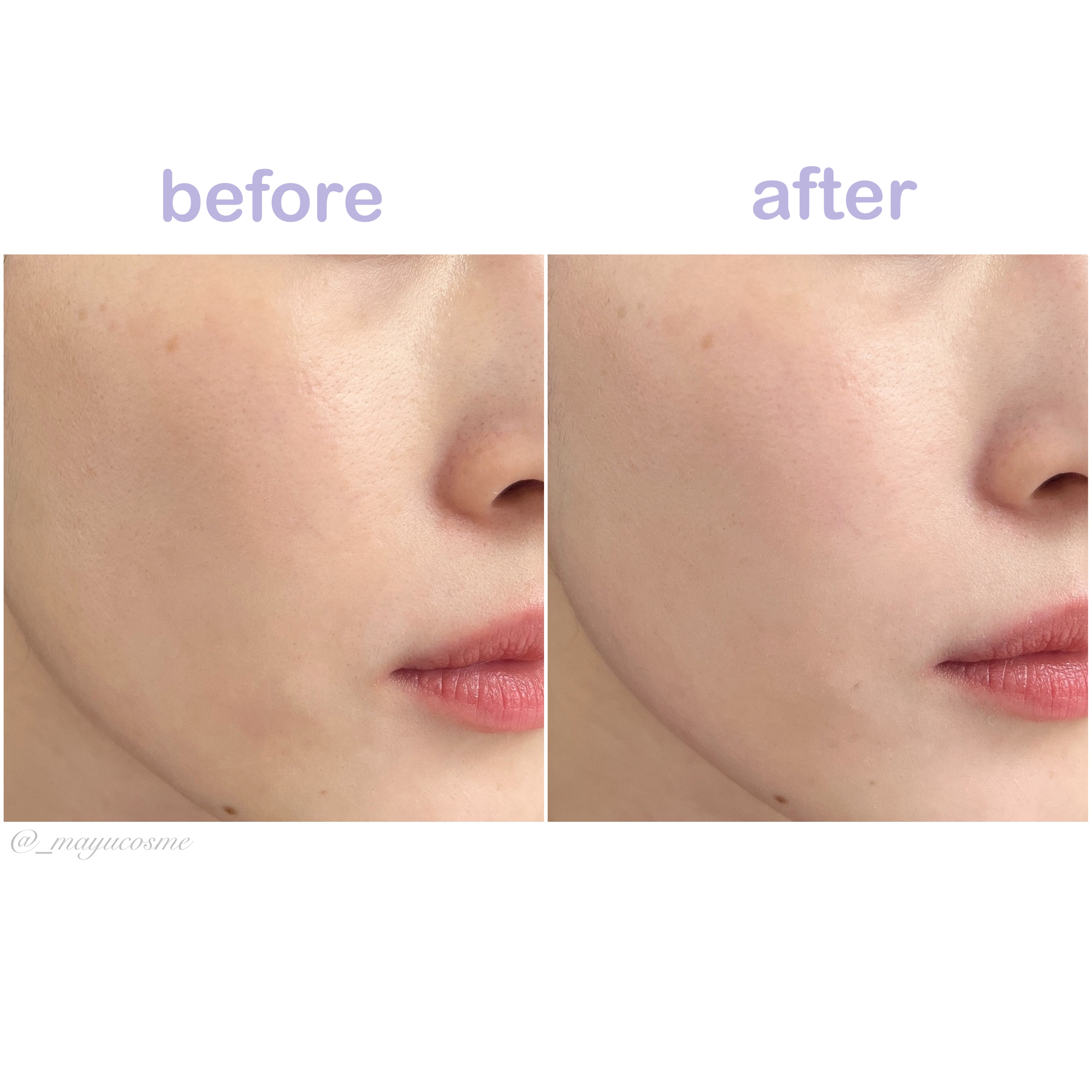 ブラックライス ピュア ミネラル リリーフ デイリー サンスクリーン/haruharu wonder/日焼け止めクリームを使ったクチコミ（3枚目）