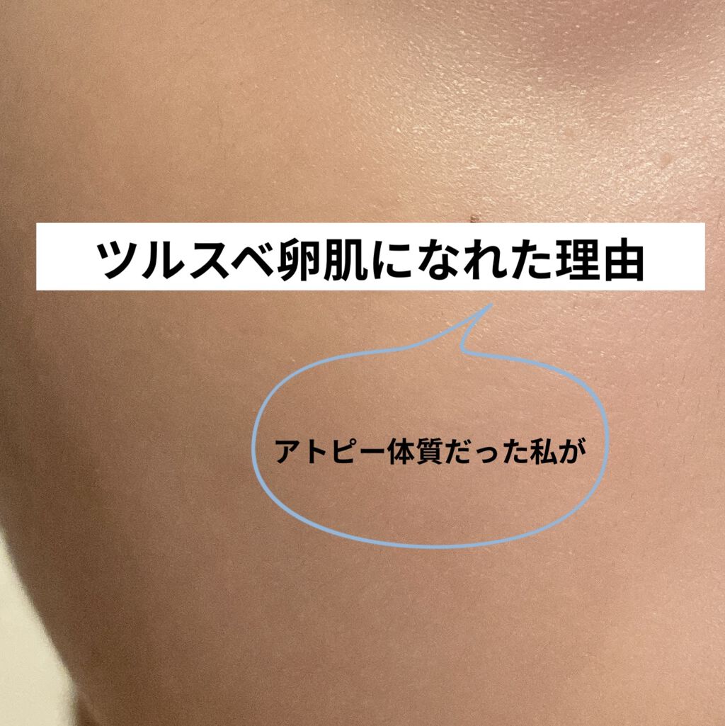 DHC ビタミンＣハードカプセル/DHC/美容サプリメントを使ったクチコミ（1枚目）