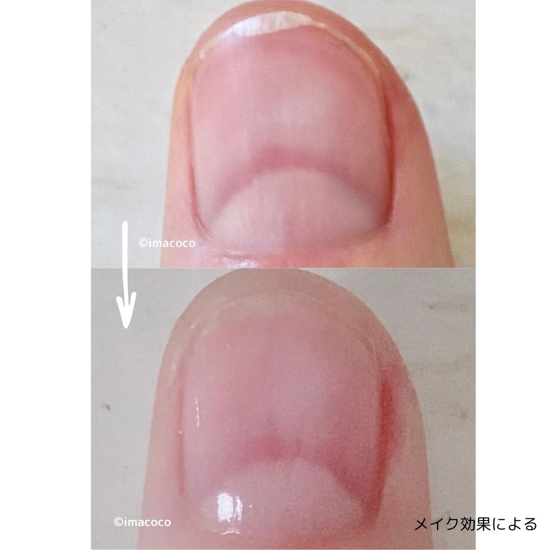 エテュセ クイックケアコート/ettusais/ネイルオイル・トリートメントを使ったクチコミ（3枚目）