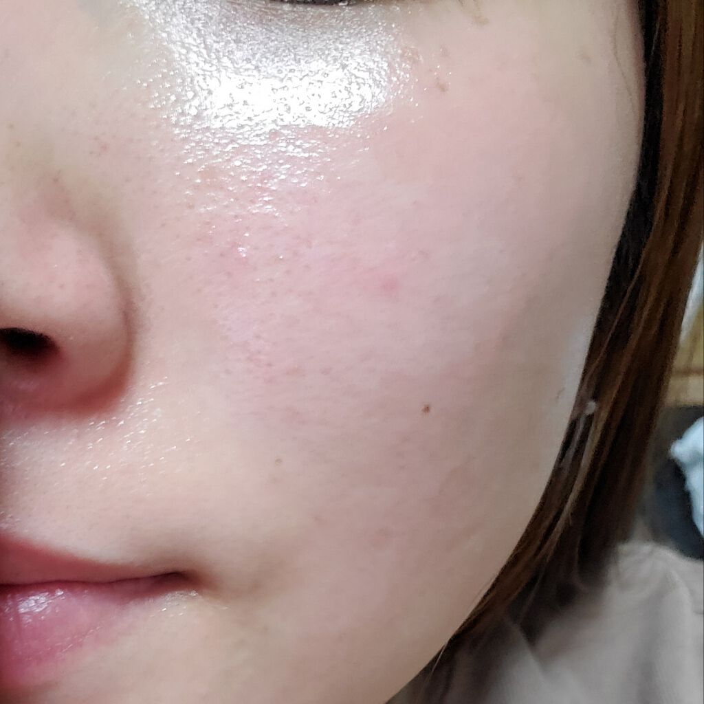 グリーンタンジェリン ビタC ダークスポットケアセラム/goodal/美容液を使ったクチコミ（3枚目）