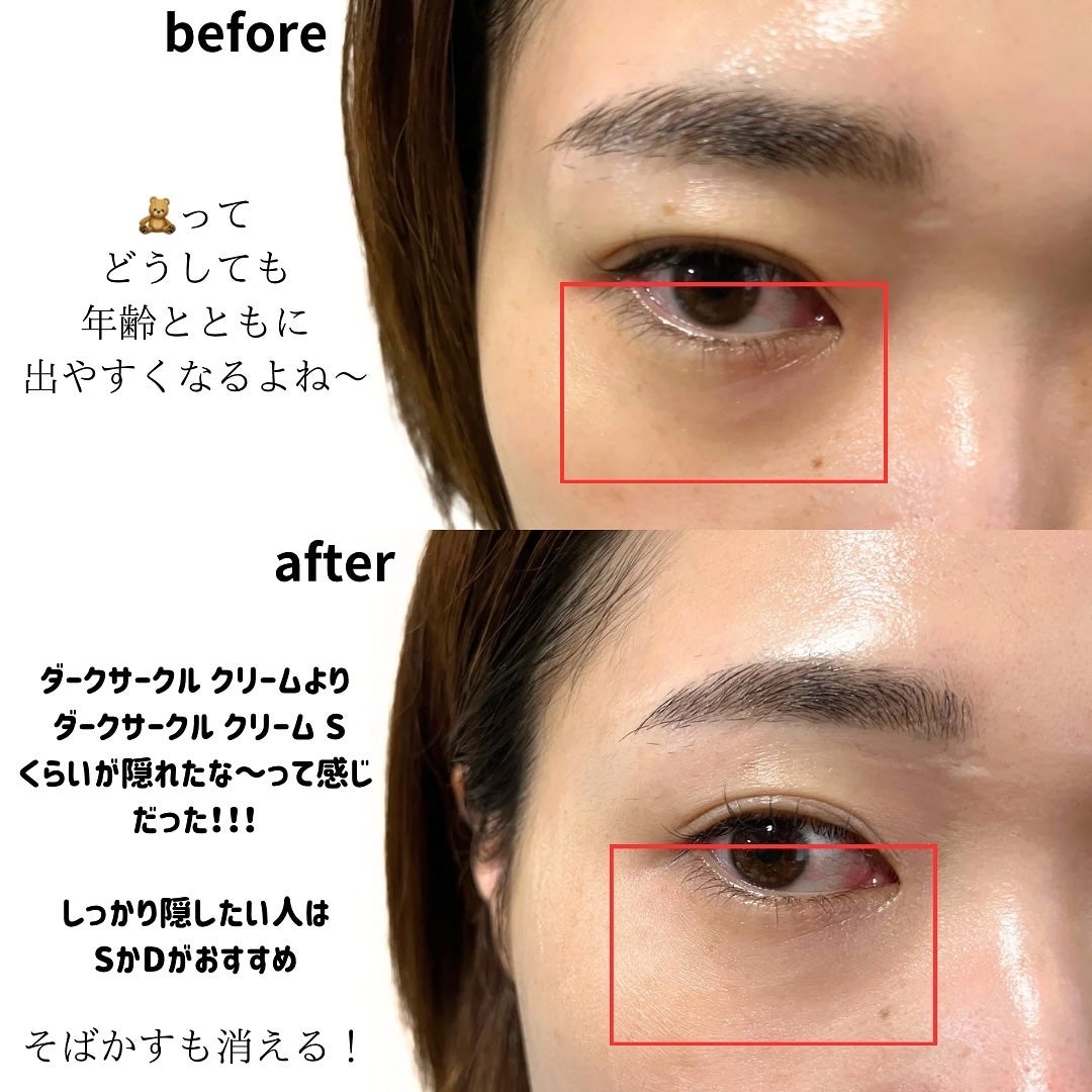 アイレノール クマクリーム/IRENOL/アイケア・アイクリームを使ったクチコミ(6枚目)