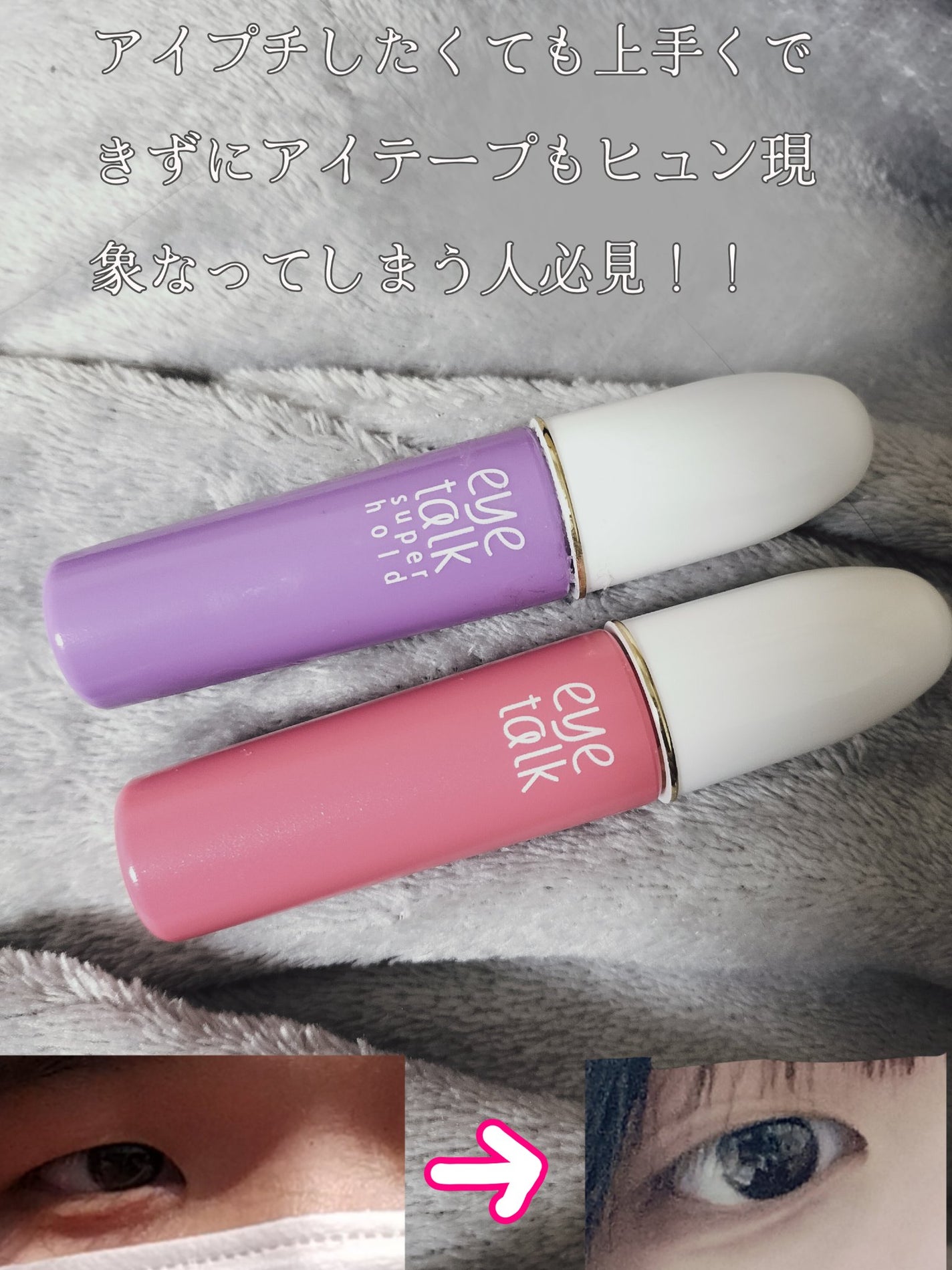 アイトーク/アイトーク/二重まぶた用アイテムを使ったクチコミ(1枚目)