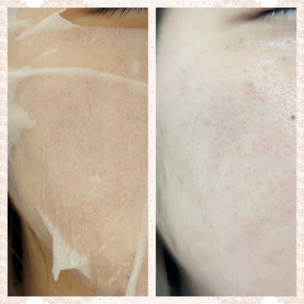 デイリーケアマスク モイスチャー/RISM/シートマスク・パックを使ったクチコミ(3枚目)