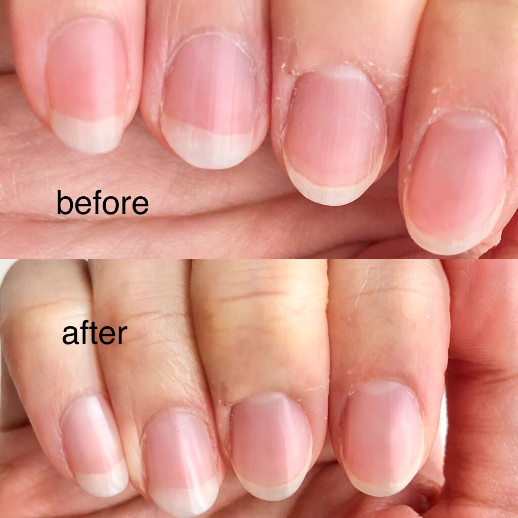 パーフェクトネイルコート/M・N・B・B/オールインワンネイルを使ったクチコミ(3枚目)