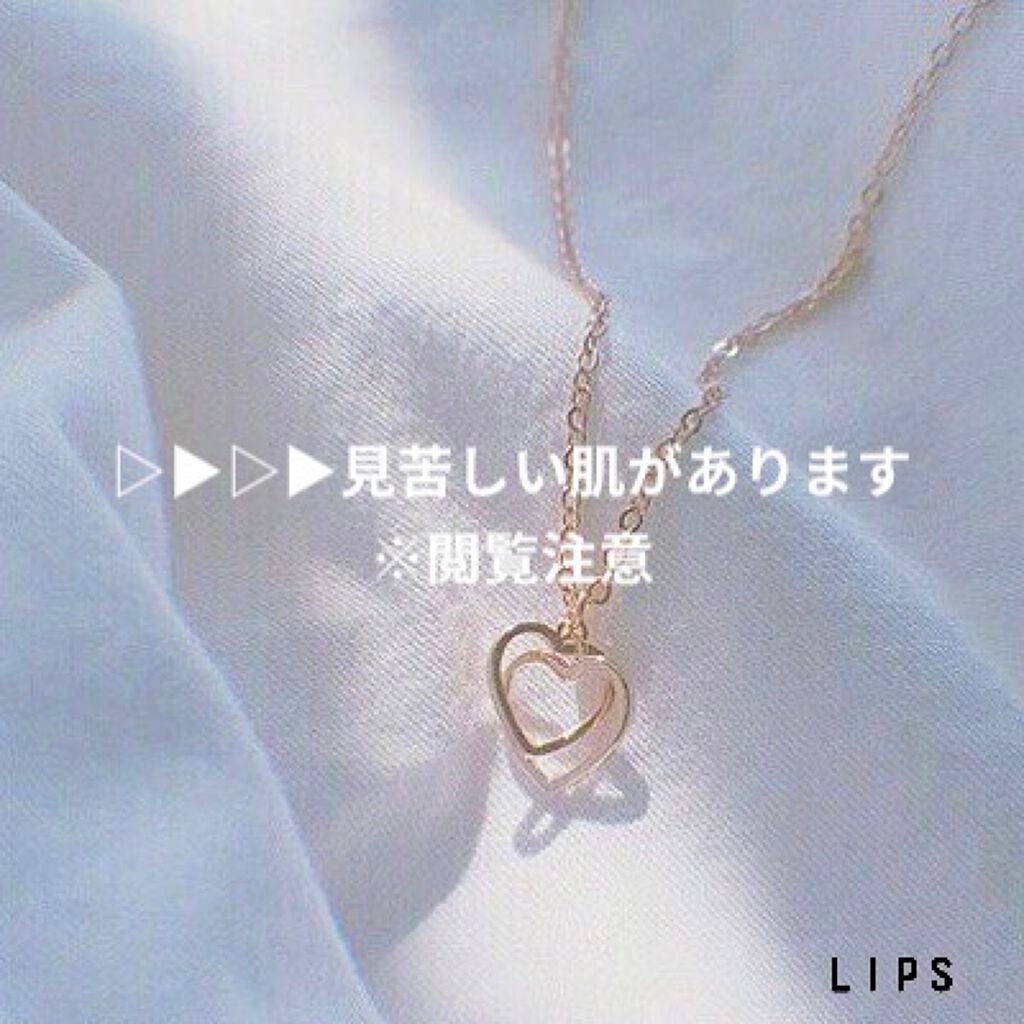 ð¥âðððððã¡ããð¥ on LIPS ã誰ãå©ããŠãã ããððçããã©ããªã¹ãã³ã±ã¢ããŠãŸããïŒ/çæŽ»..ãïŒ1æç®ïŒ