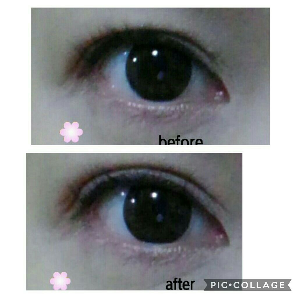 アイトーク スーパーウォータープルーフ/アイトーク/二重まぶた用アイテムを使ったクチコミ（3枚目）