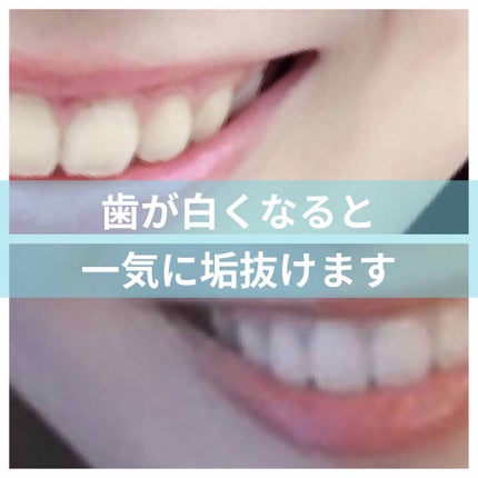 を使ったクチコミ(1枚目)