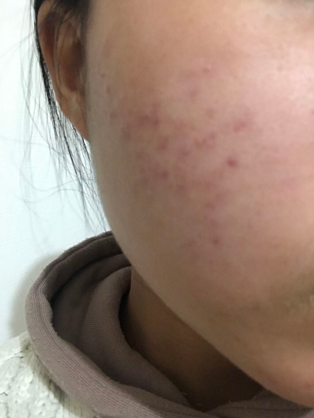 ハトムギ化粧水(ナチュリエ スキンコンディショナー R )/ナチュリエ/化粧水を使ったクチコミ(1枚目)