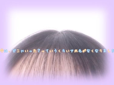 あほ毛レスキュー/キャンドゥ/ヘアバームを使ったクチコミ（5枚目）