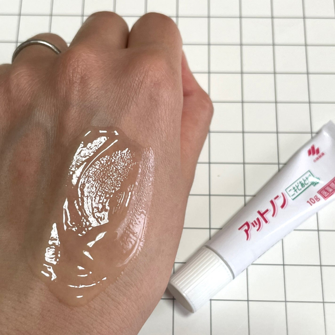 ニキビあとケアジェル/アットノン/その他スキンケアを使ったクチコミ(3枚目)