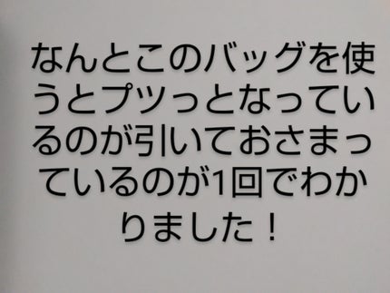 ごめんね素肌 キニナルマスク/クリアターン/シートマスク・パックを使ったクチコミ(3枚目)